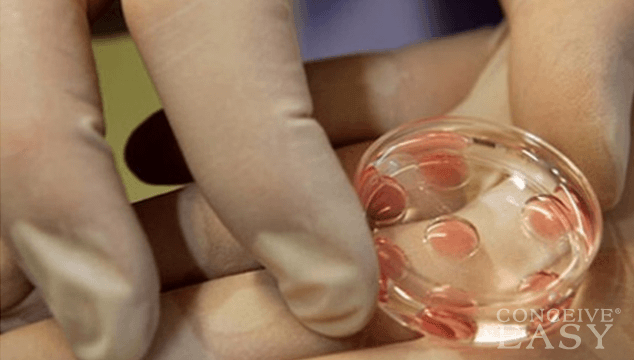 In Vitro After 50