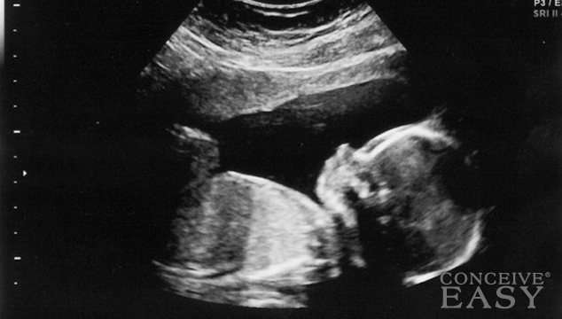 Signs that My Unborn Baby is Under Stress