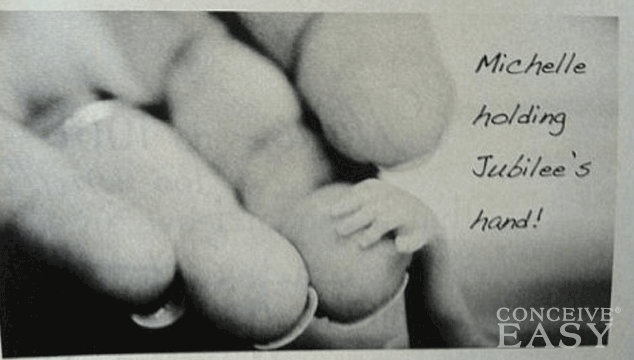 Stillbirth, Neonatal Death and Late Term Pregnancy Loss