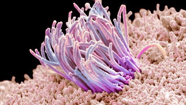 Tubal Cannulation
