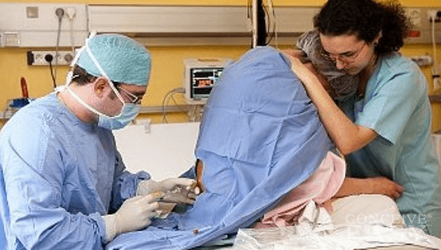 What Happens During an Epidural?