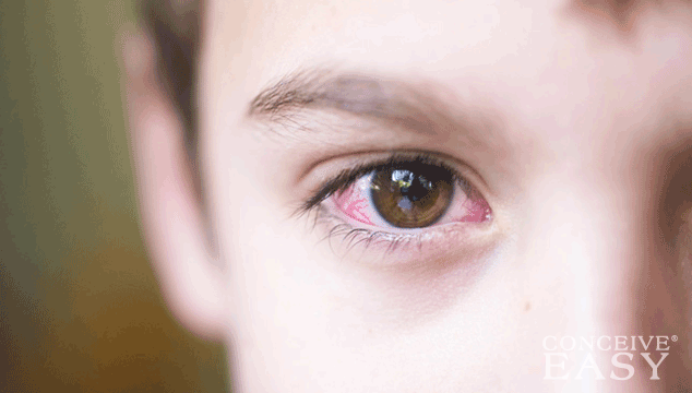 home-remedies-for-pink-eye-for-infants home-remedies-for-pink-eye-for-infants