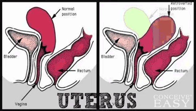 I Have Pcos And Want To Get Pregnant 14