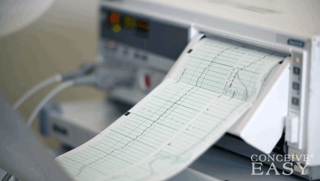 fetal-distress-in-labor-and-delivery fetal-distress-in-labor-and-delivery
