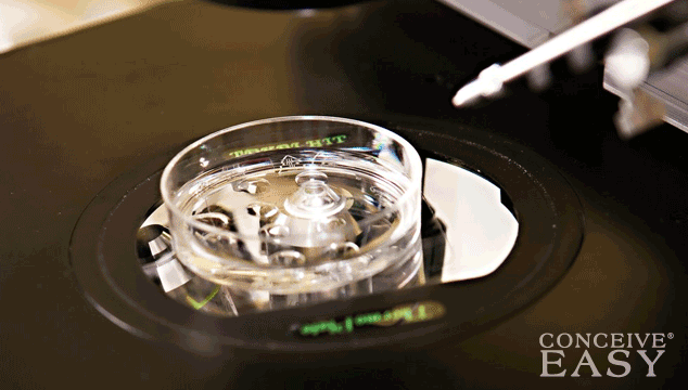 tubal-reversal-vs-ivf-which-is-the-best-choice tubal-reversal-vs-ivf-which-is-the-best-choice