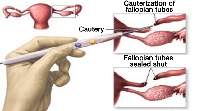 Why Is Smoking Bad For Your Heart