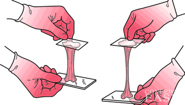 What Does Cervical Mucus Look Like When First Pregnant ...