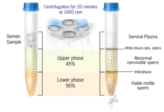 Sperm washing concerns