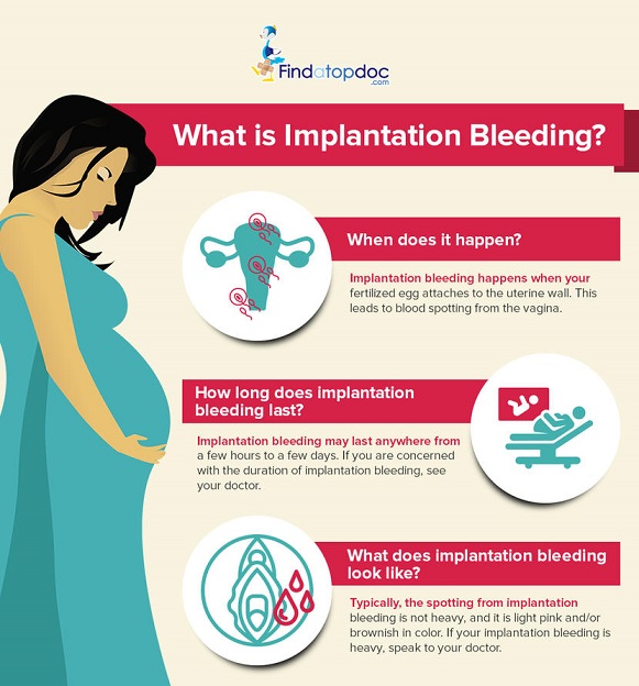 Implantation_Bleeding – ConceiveEasy.com