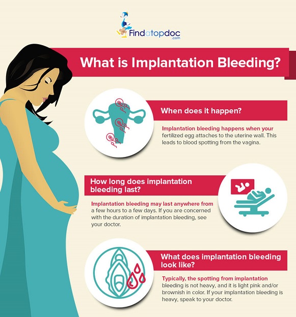 Spotting Vs Period Is It Aunt Flo Or Early Pregnancy Bleeding