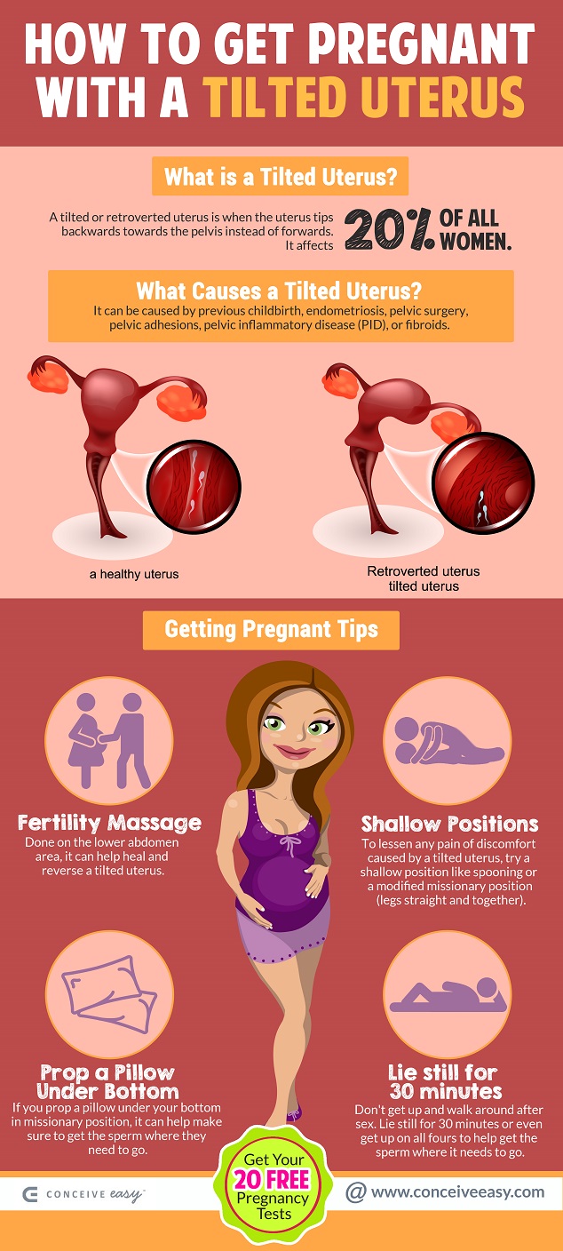 How to Get Pregnant With Tilted Uterus – ConceiveEasy.com