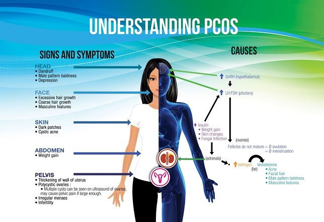 What Are the Best 10 Herbs for PCOS? – conceiveeasy.com