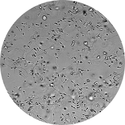 xxx pics - Conception with low sperm count low sperm with count Conception